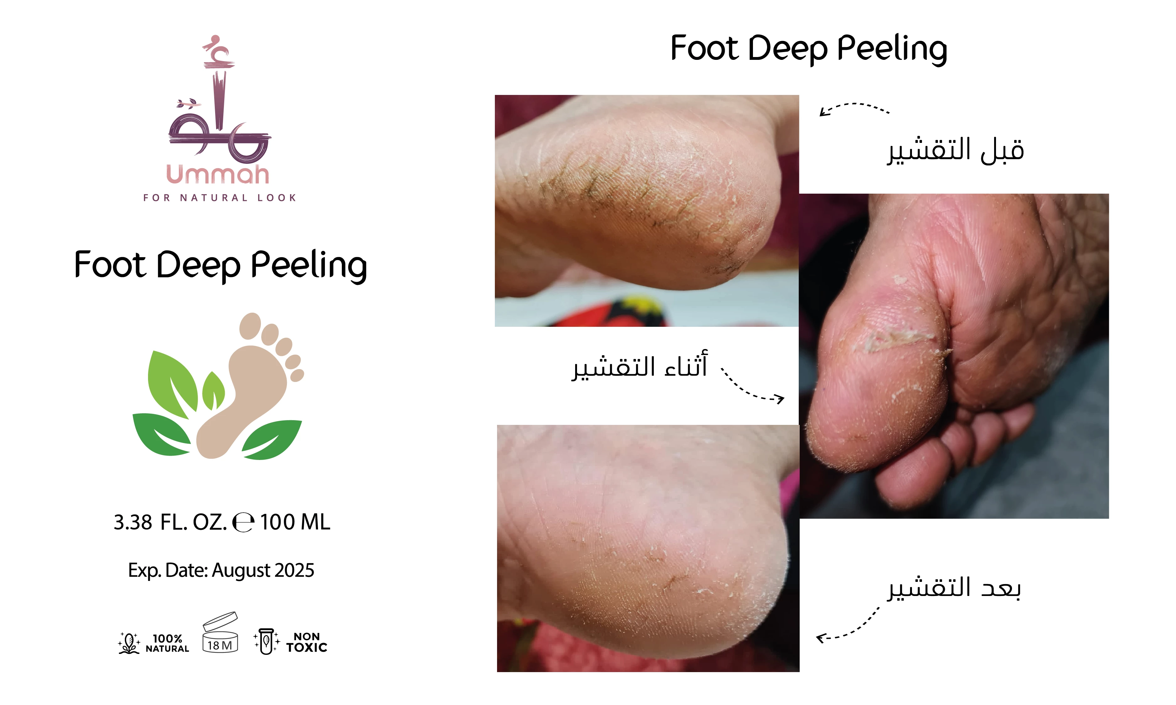 مقشر القدم للتشققات - Foot Deep Peeling